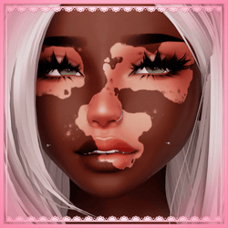 FREE Vitiligo Pack by Nessy!