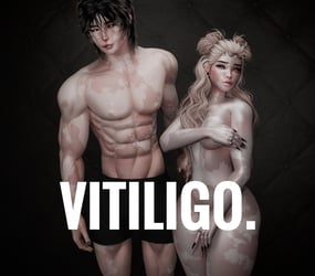 4K VITILIGO IMPERFECTION TEXTURE - MALE
