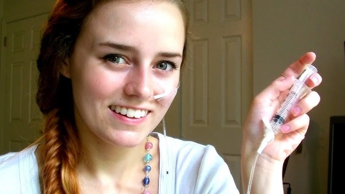 التغذية الأنبوبية في المنزل في دبي