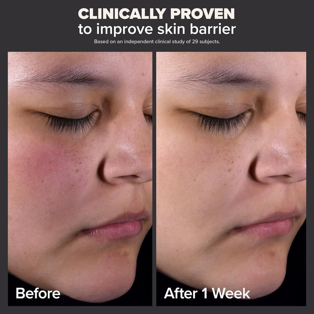 exfoliator for large pores