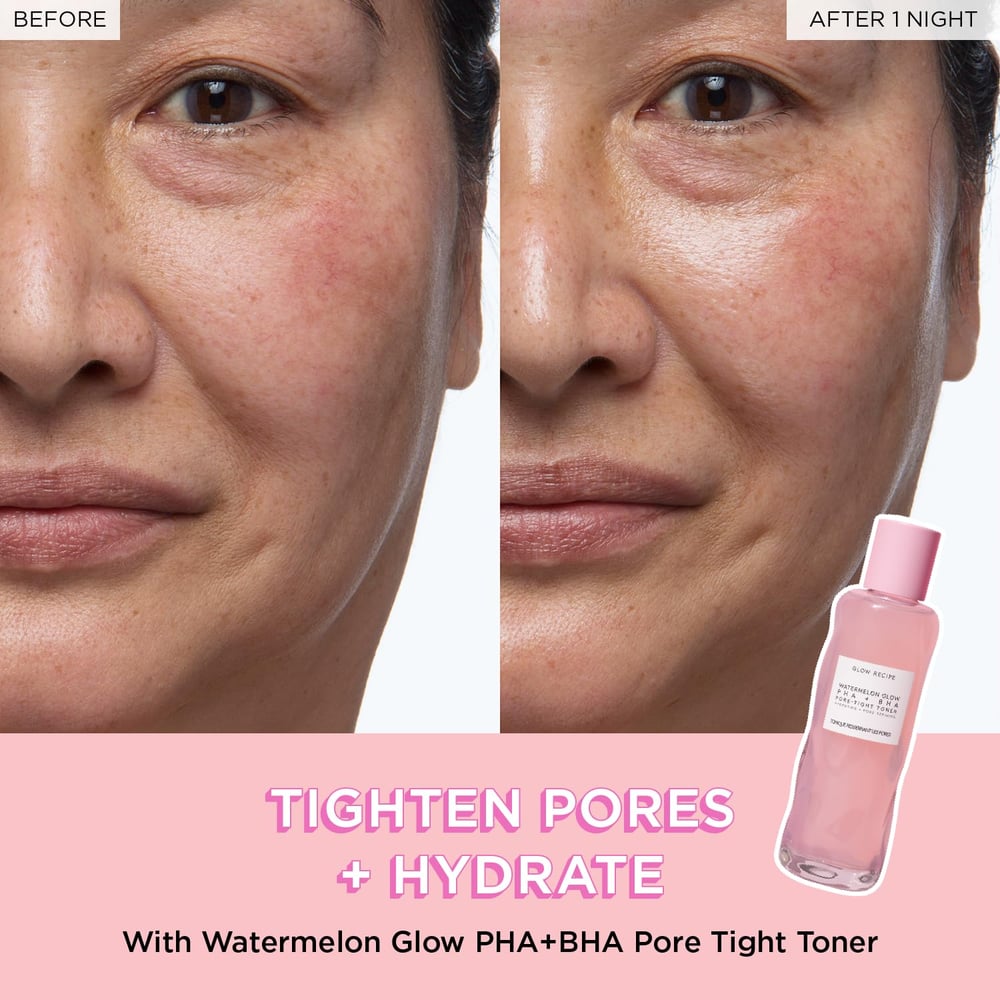 exfoliator for large pores