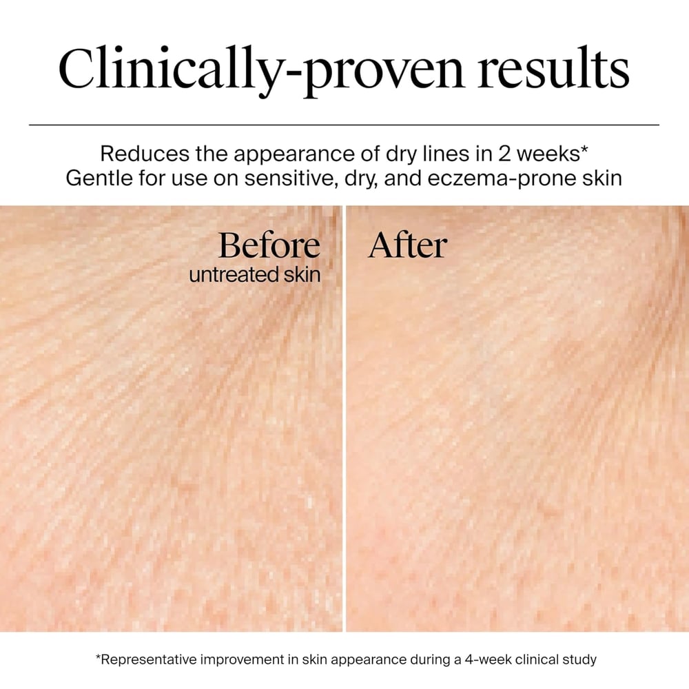 moisturiser for peeling skin