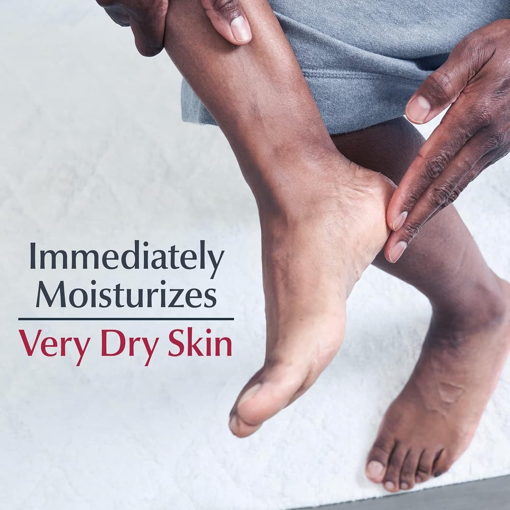 moisturiser for peeling skin