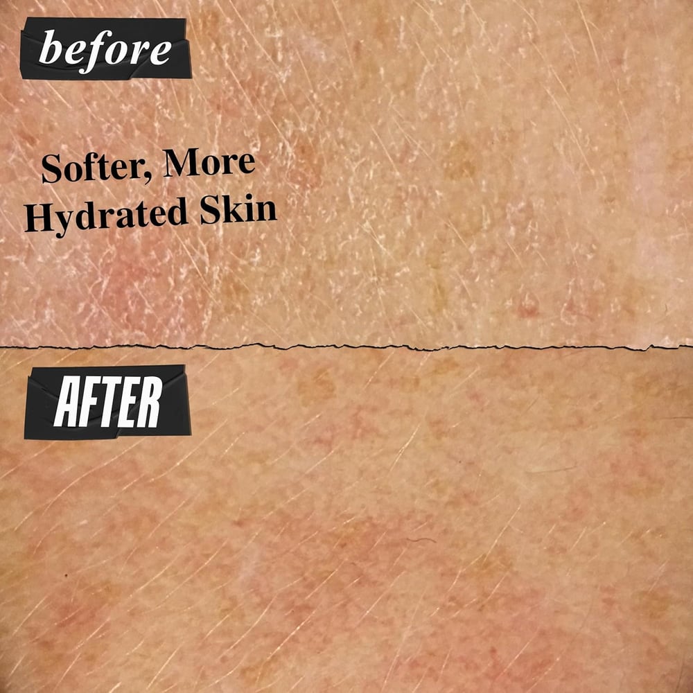 moisturizer for dry skin