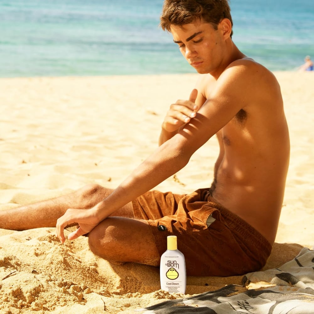 moisturizer for sunburn