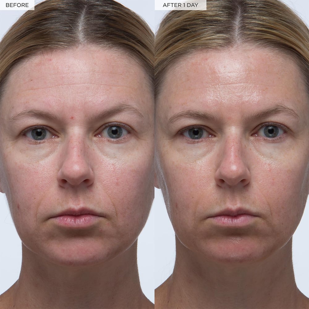 hyaluronic acid skin care products