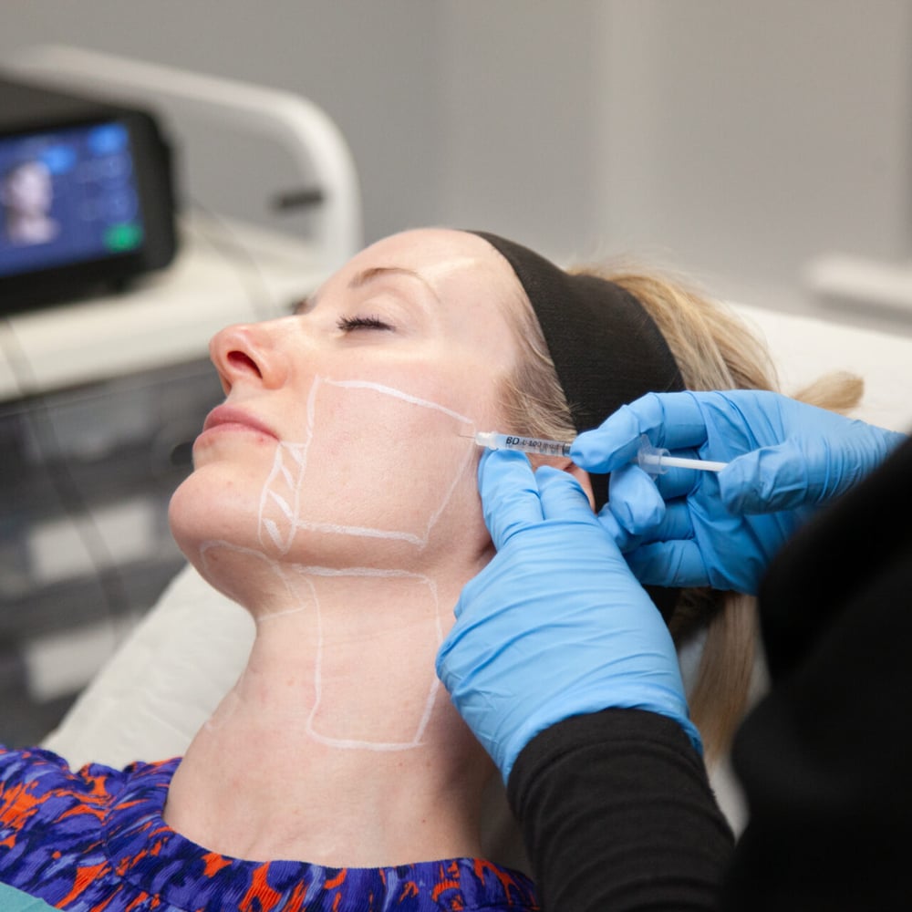 Endolift in Dubai