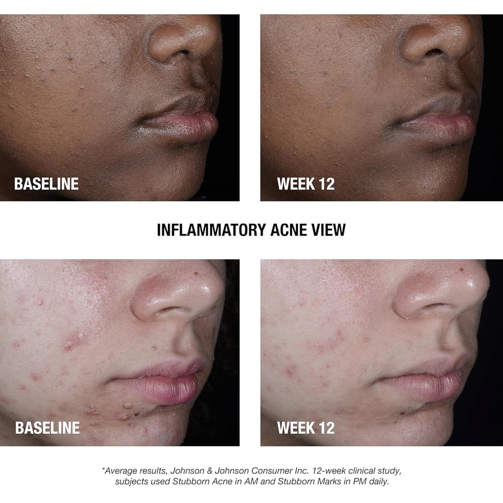 neutrogena skin care products