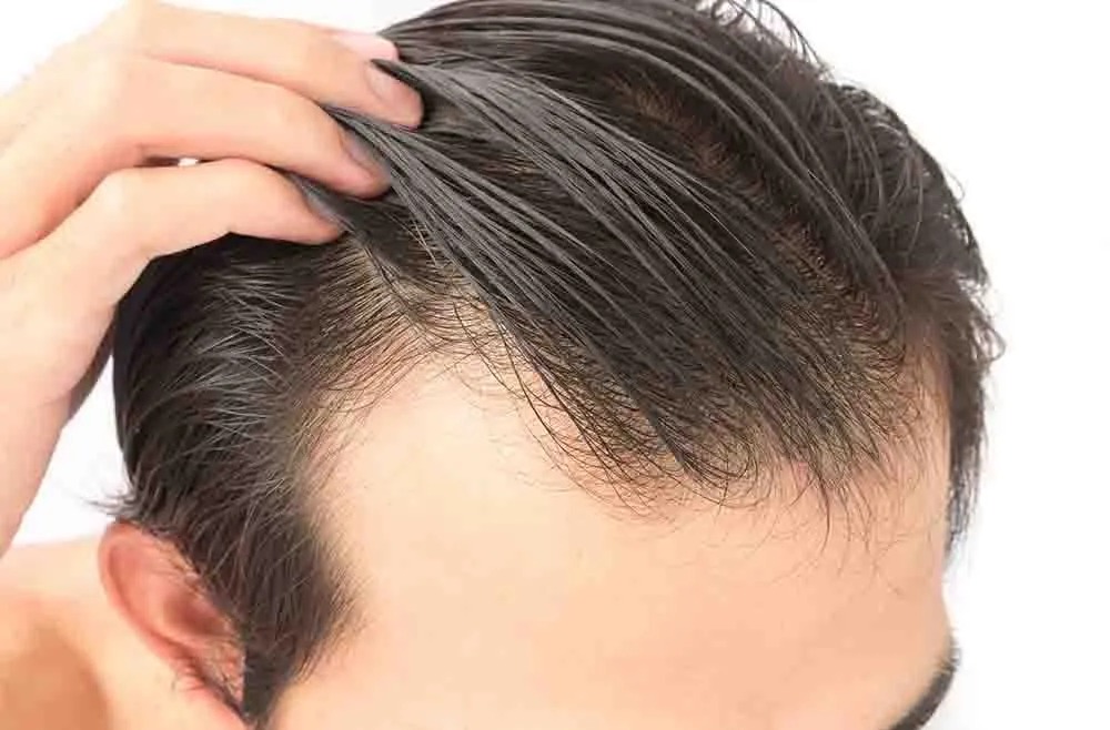 Front Line Hair Fixing in Dubai