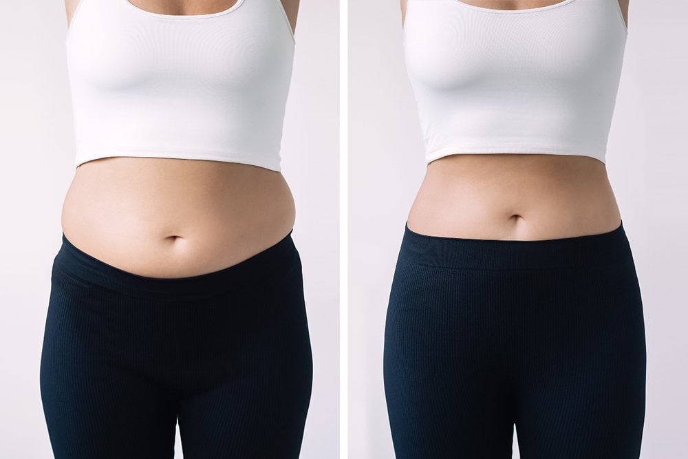 Weight Loss Clinic in Dubai