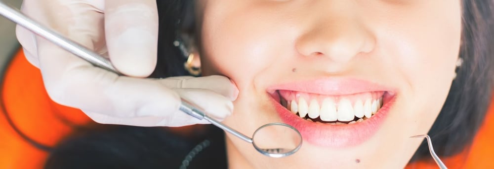 Dental Crowns and Bridges in Dubai