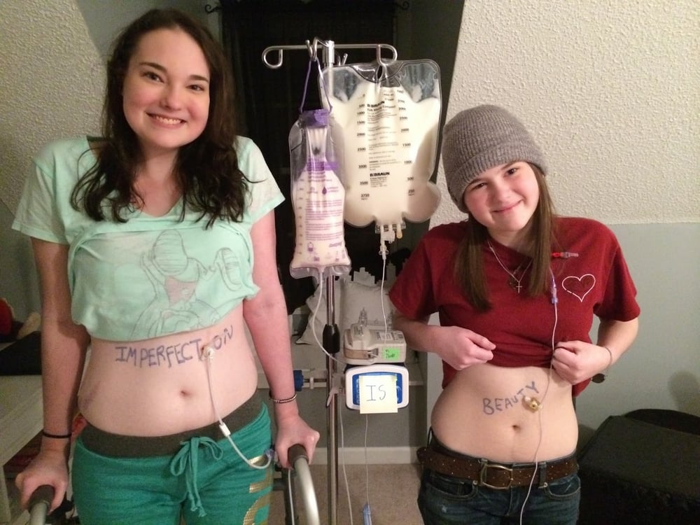 Tube Feeding at home in Dubai