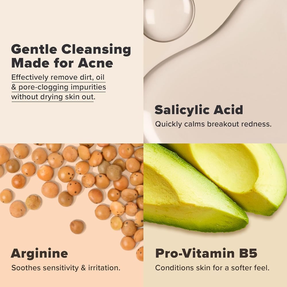 salicylic acid blackhead