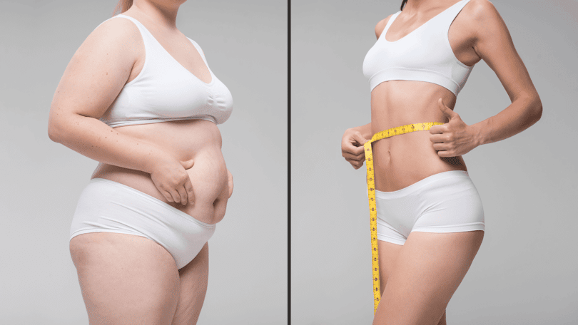 Weight Loss Clinic in Dubai