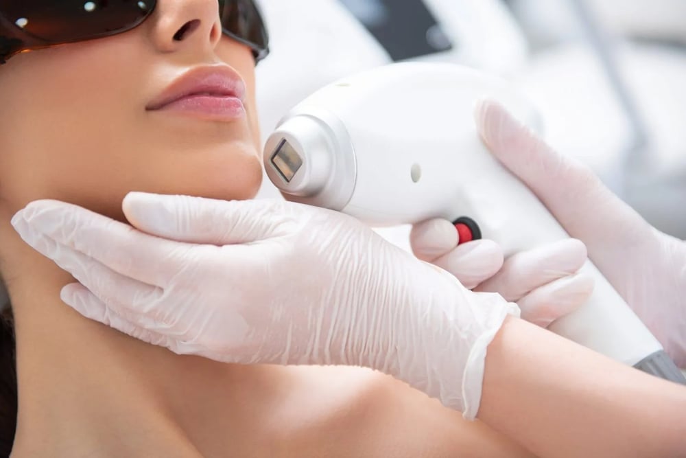Laser Skincare Treatments