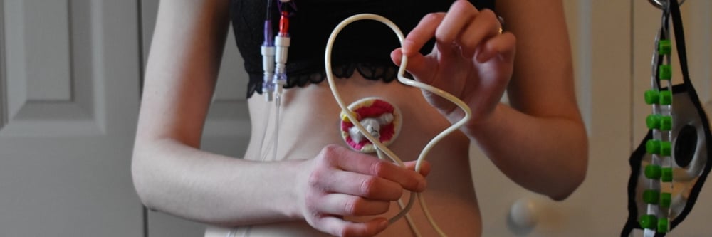 Tube Feeding at home