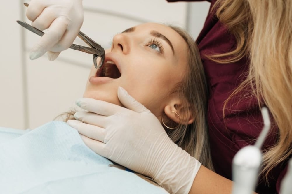 Tooth Extraction