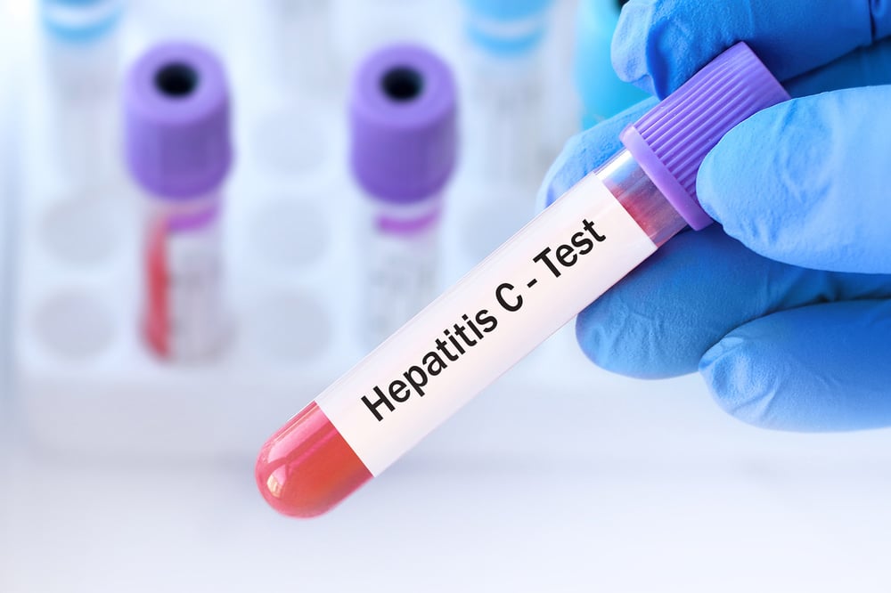Hepatitis C Test