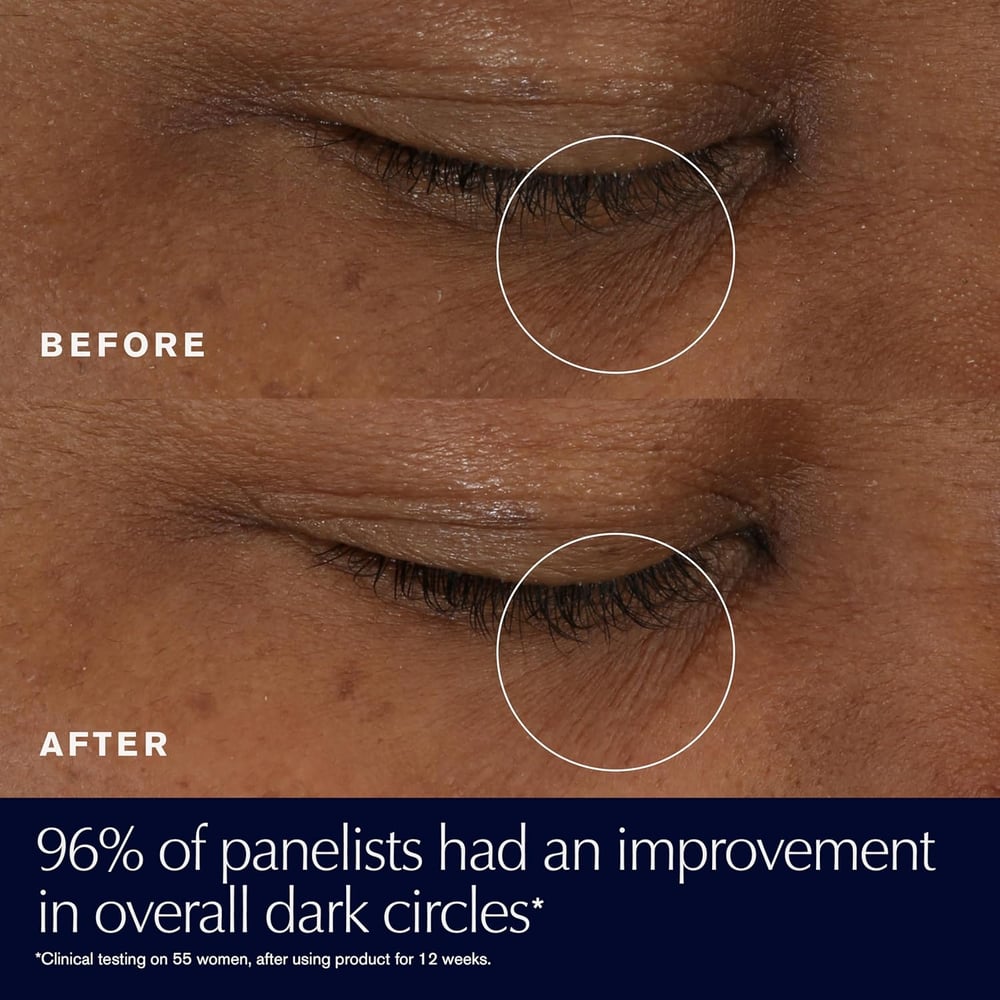 eye creams for bags under eyes