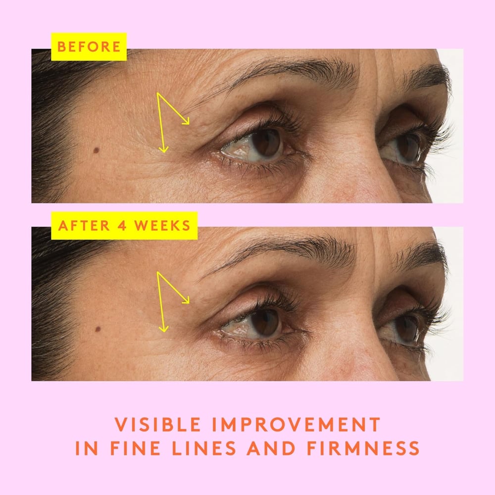 eye creams for bags under eyes