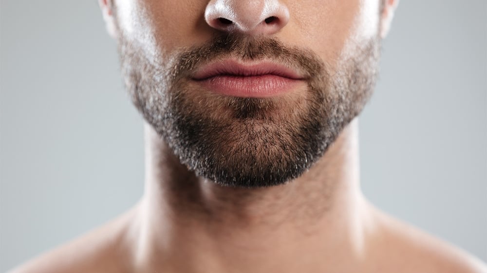 Beard Hair Transplant in Dubai