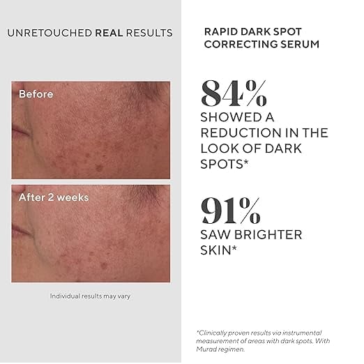 skincare for dark spots