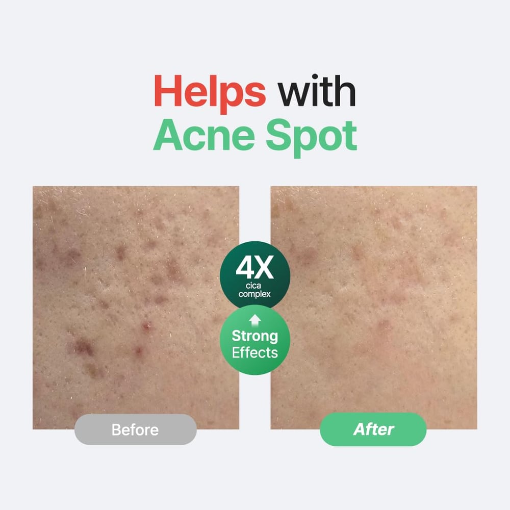 korean skin products for dark spots