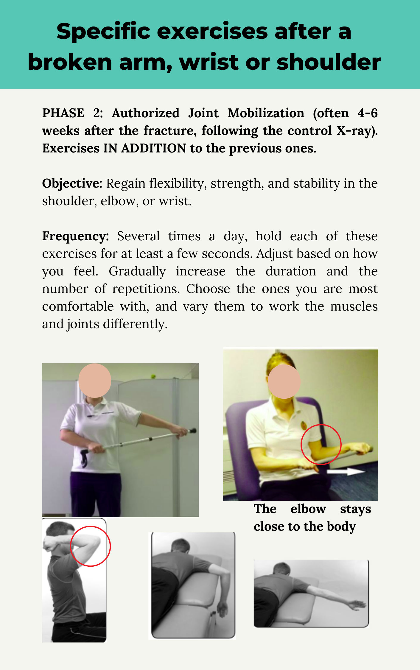 Humerus Fracture - Whats is the Recovery Time? Physio'Advice