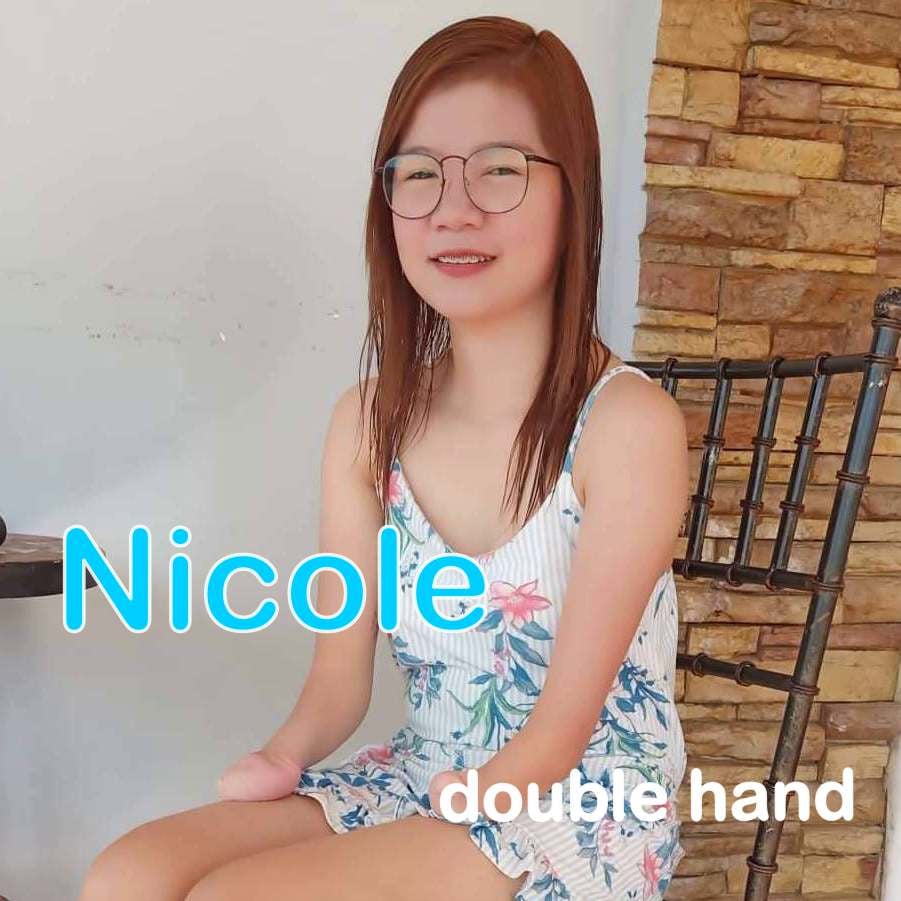 Nicole double hand amputee