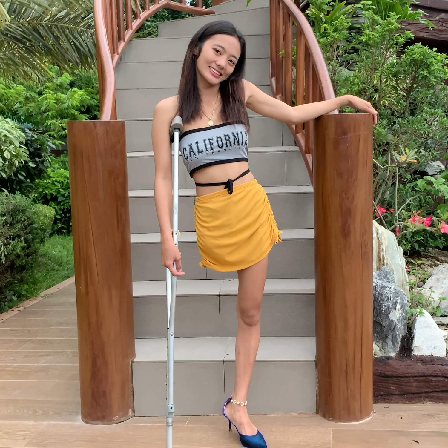Cathy right above the knee amputee