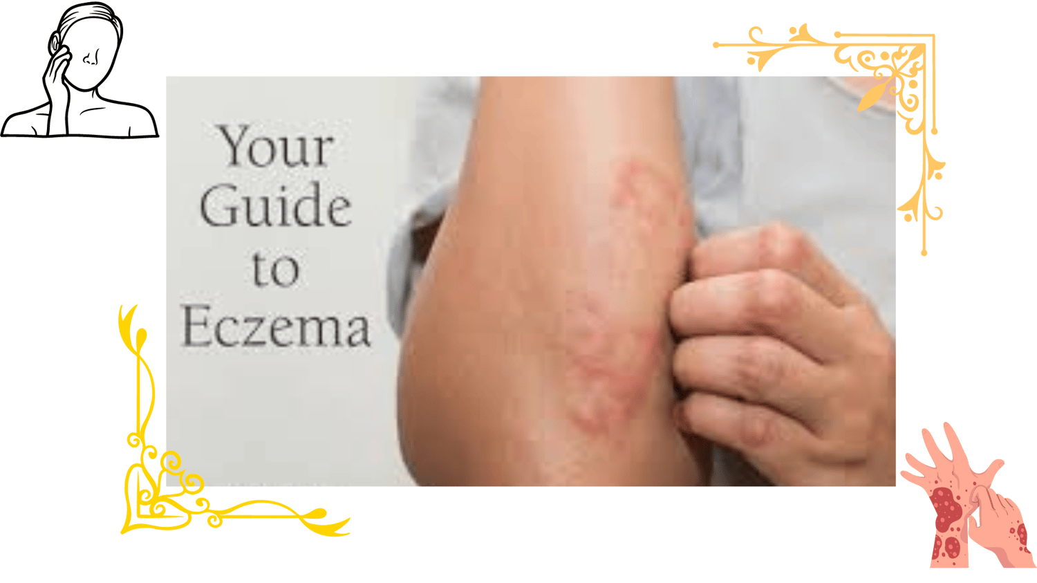 Eczema Skin Issues