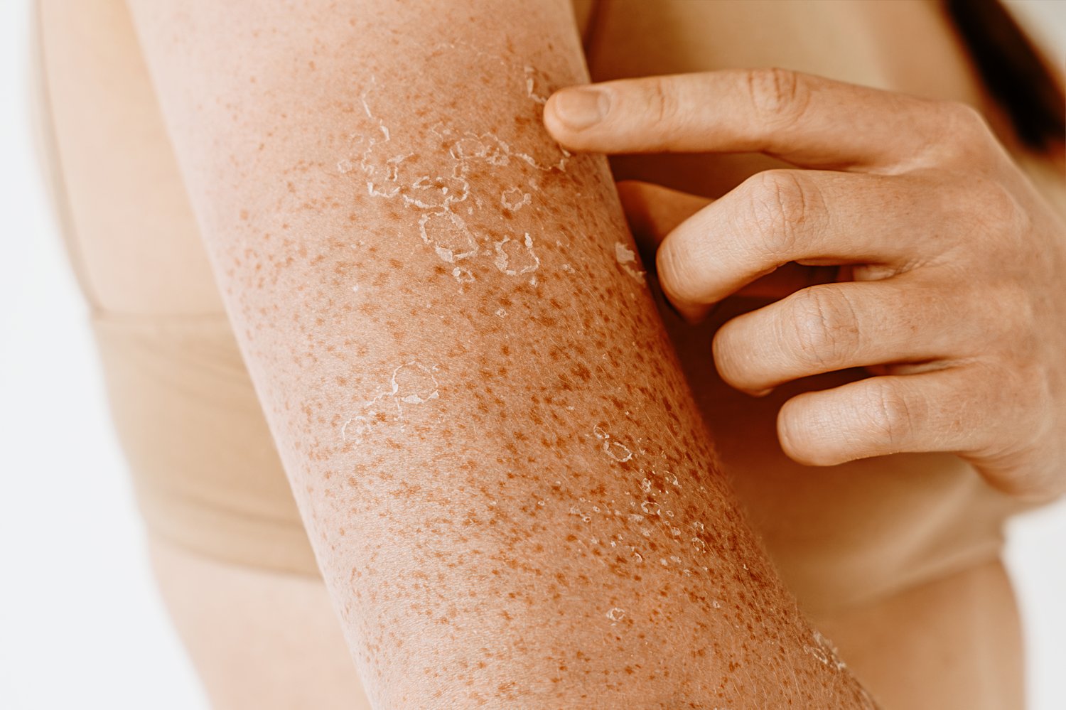 gentle cleanser for dry skin