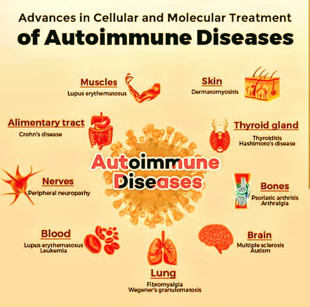 Smart Management of Autoimmune Disease
