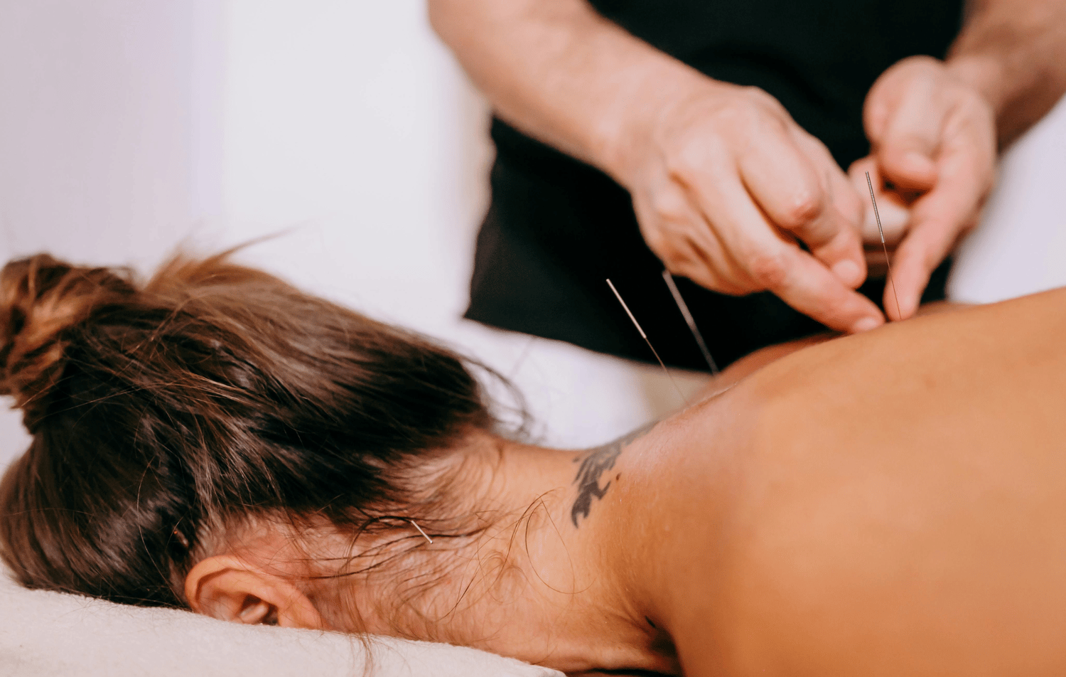 acupuncture chinese medicine holistic lower back pain thyroid pcos adhd