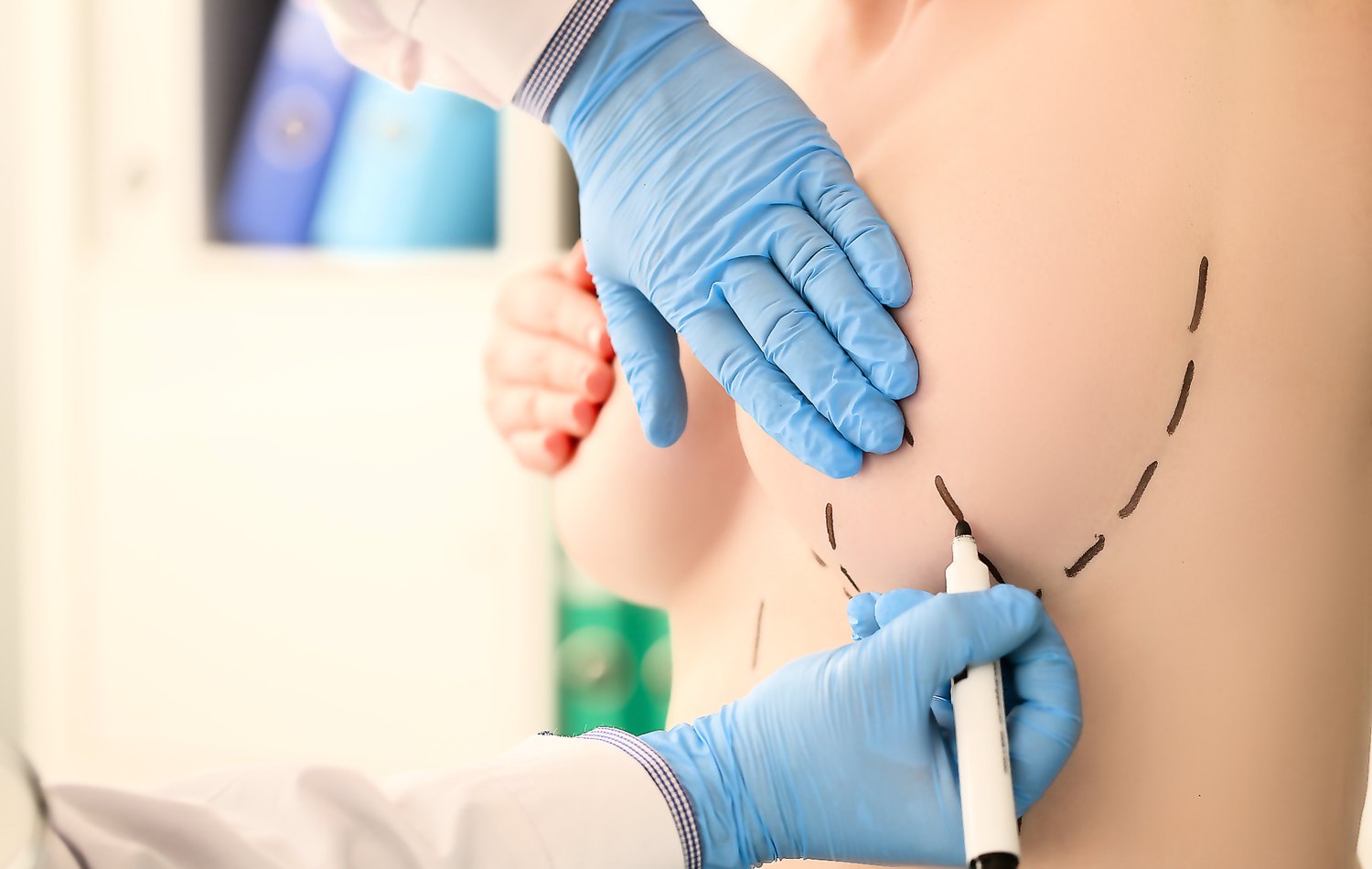 Breast reduction in Riyadh