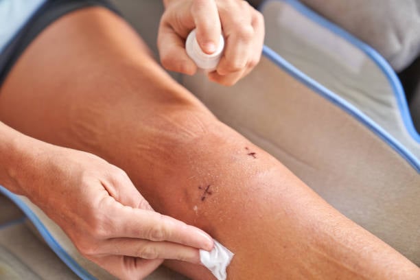 Vascular Surgery in Riyadh