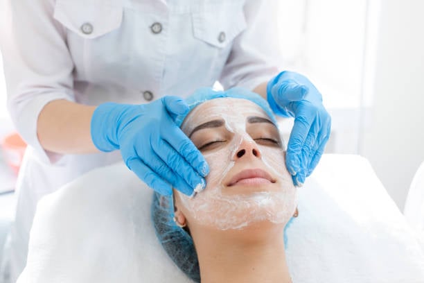 Chemical Peels in Riyadh
