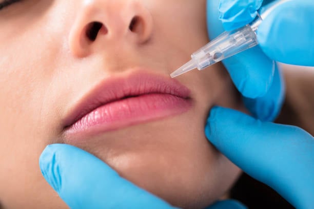 Botox Lipflip in Riyadh