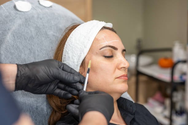 Brow Lift Surgery in Riyadh