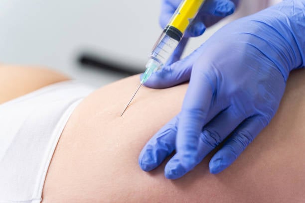 الفرق بين حقن السكلبترا وحقن الراديس