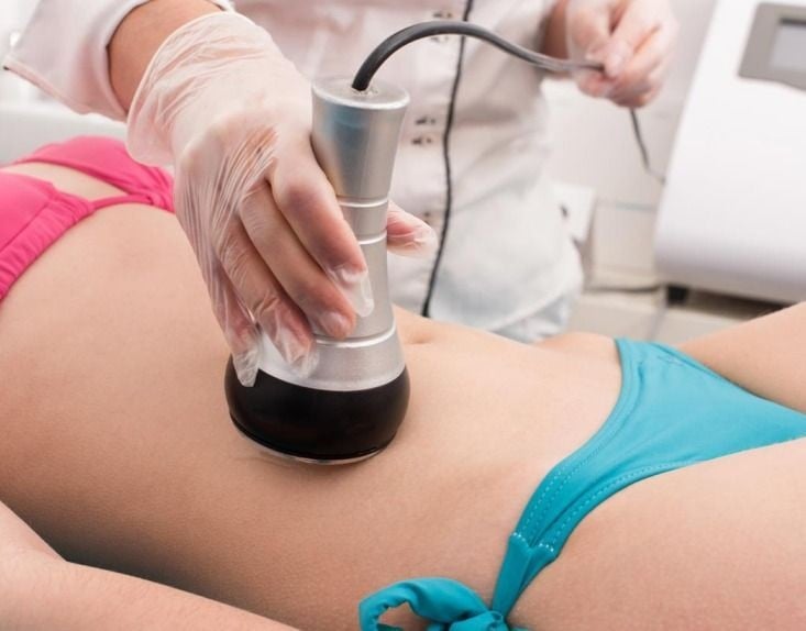 Laser Liposuction in Riyadh