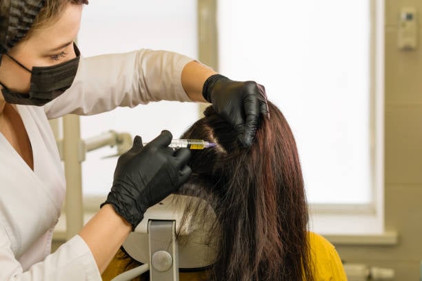 PRP Hair Treatment in Riyadh