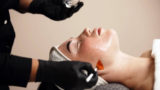 Chemical Peels in Riyadh