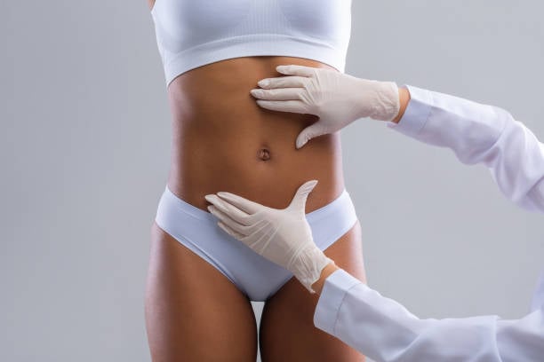 Liposuction in Riyadh
