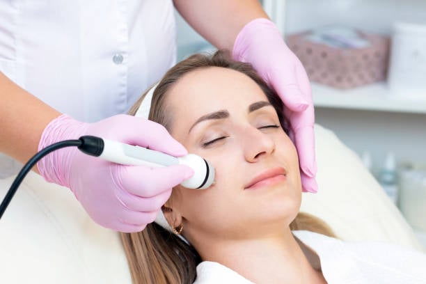 Laser Skincare Treatments