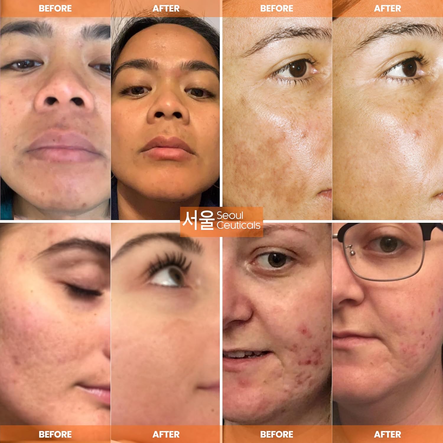 skin products for hyperpigmentation