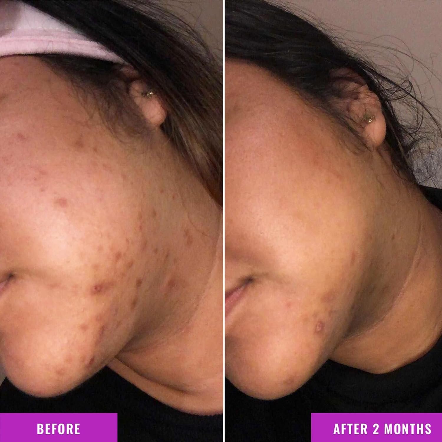 SkinCeuticals face products for dark spots serum