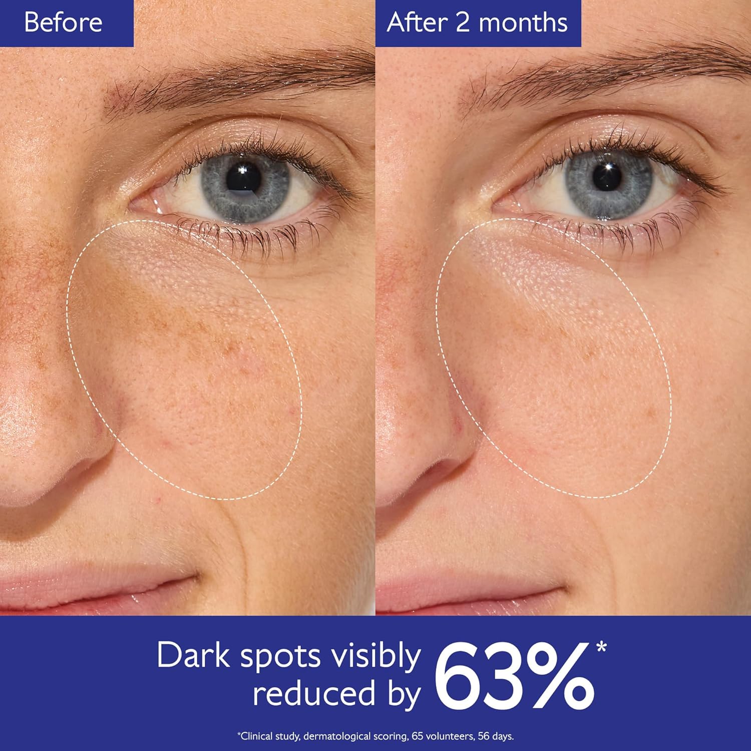 Caudalie vinoperfect skin care hyperpigmentation