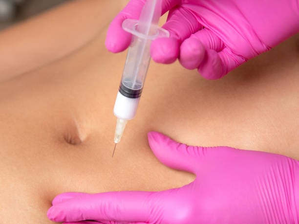 حقن إذابة الدهون في الرياض