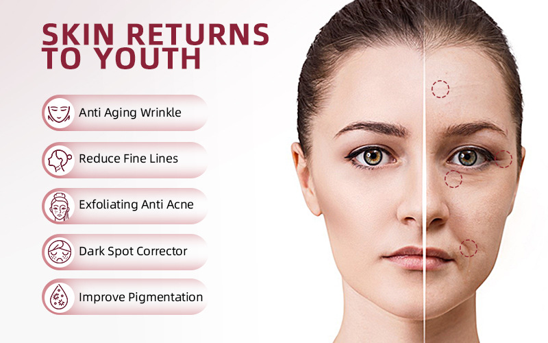 Kormesic chemical exfoliating serum featuring AHA 30% and BHA 2%, 30ml.